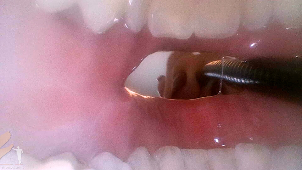 Remedy - Mouth Cam - 1080